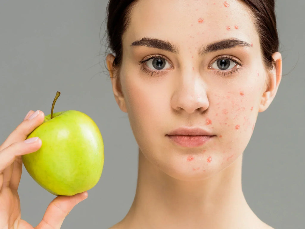 How your diet affects your skin